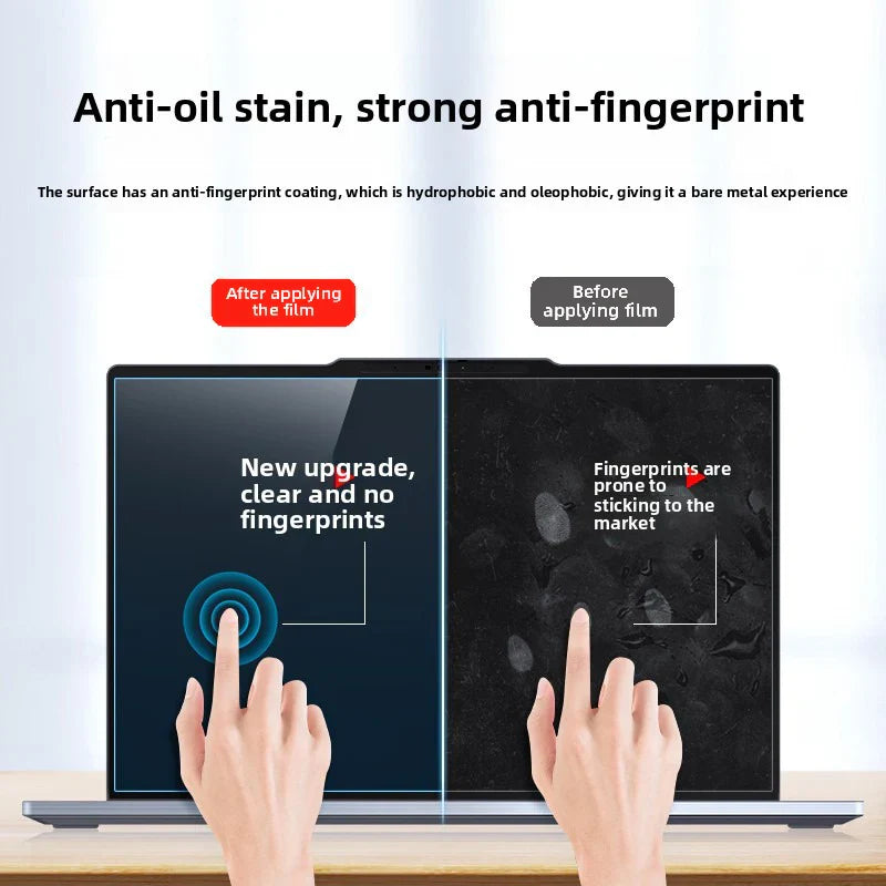 MacBook Neo Shield Kit